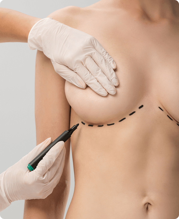 Breast Augmentation Surgery