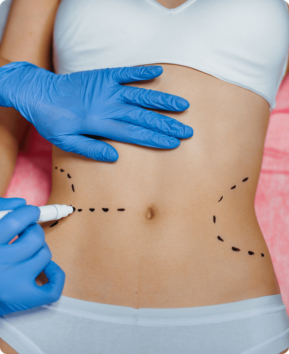 Lipo to Remove Stubborn Fat