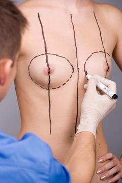 Breast Augmentation Surgeon