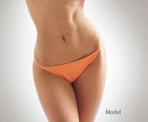 Abdominoplasty