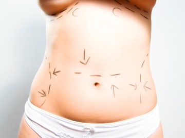 Choosing the Best Plastic Surgeon