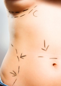 Tummy Tuck Surgery