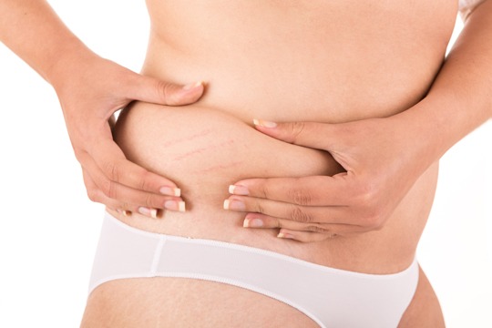 Tummy Tuck Plastic Surgery Houston