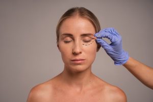 Upper or Lower Blepharoplasty