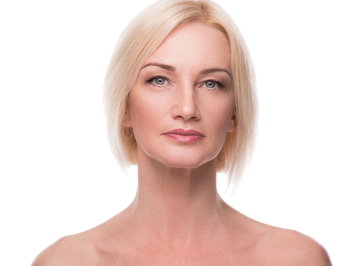 Facelift