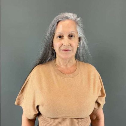 Neck Lift Before & After Patient #1671