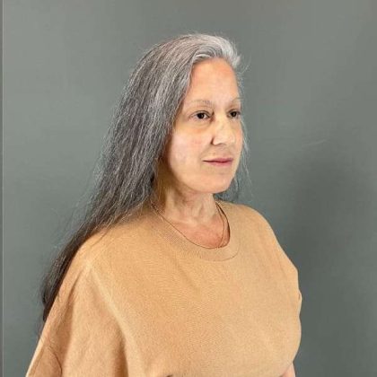 Neck Lift Before & After Patient #1671