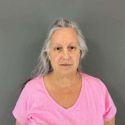 Neck Lift Before & After Patient #1671